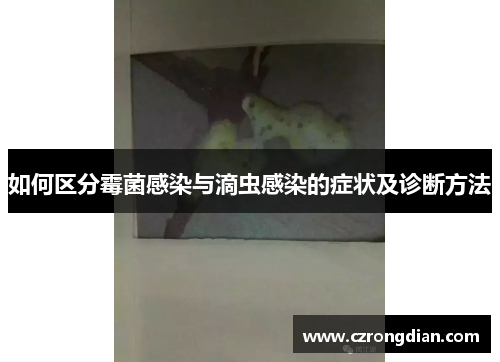 如何区分霉菌感染与滴虫感染的症状及诊断方法 如何区分霉菌感染与滴虫感染的症状及诊断方法